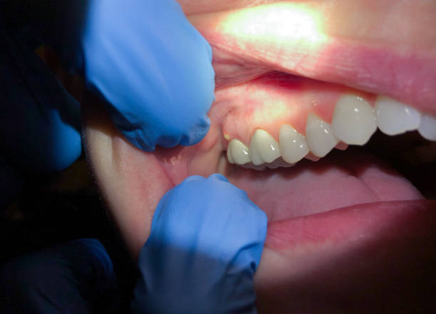 Best Emergency Dental Services for Seniors in Twisp, WA